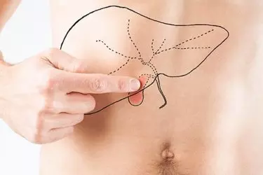 best treatment of gall stones in purnia