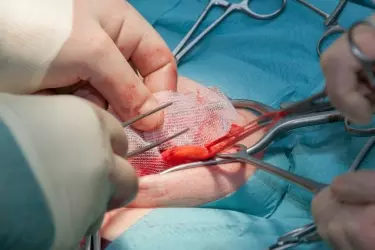 best hospital for hernia treatment in purnia