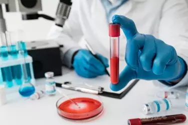 accurate blood tests in purnia