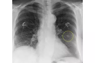 fully digital xray at anand hospital purnia